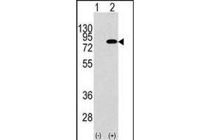 Western blot analysis of PIK3R2 (arrow) using rabbit polyclonal PIK3R2 Antibody  (R). (PIK3R2 抗体  (AA 445-474))