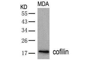Western blot analysis of extracts from MDA cells using cofilin(Ab-3) Antibody. (Cofilin 抗体  (AA 1-5))