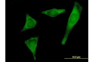 Immunofluorescence of purified MaxPab antibody to PRPSAP2 on HeLa cell. (PRPSAP2 抗体  (AA 1-369))