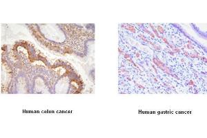 Immunohistochemistry (IHC) image for anti-EPH Receptor A2 (EPHA2) (AA 559-976) antibody (ABIN317512) (EPH Receptor A2 抗体  (AA 559-976))