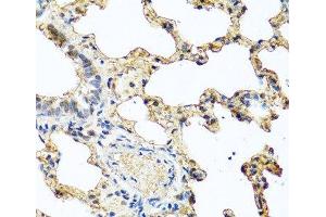 Immunohistochemistry of paraffin-embedded Rat lung using PIP Polyclonal Antibody at dilution of 1:100 (40x lens). (PIP 抗体)
