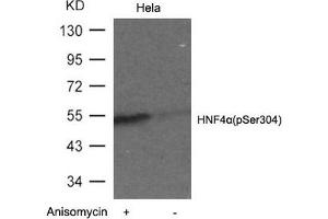 Western blot analysis of extracts from Hela cells untreated or treated with Anisomyclin using HNF4a(Phospho-Ser304) Antibody. (HNF4A 抗体  (pSer304))