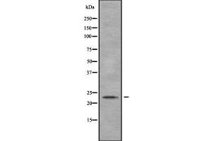 Western Blotting (WB) image for anti-Myosin Light Chain 4, Alkali, Atrial, Embryonic (MYL4) (N-Term) antibody (ABIN6263472)