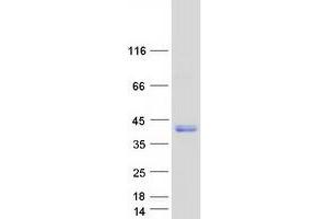 Western Blotting (WB) image for Peripherin 2 (Retinal Degeneration, Slow) (PRPH2) protein (Myc-DYKDDDDK Tag) (ABIN2728685)