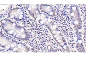 Detection of ASPH in Human Small intestine Tissue using Polyclonal Antibody to Aspartate Beta Hydroxylase (ASPH) (Aspartate beta Hydroxylase 抗体  (AA 345-758))
