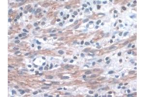 Detection of ITGa3 in Mouse Uterus Tissue using Polyclonal Antibody to Integrin Alpha 3 (ITGa3) (ITGA3 抗体  (AA 33-236))