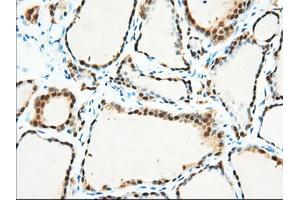 Immunohistochemical staining of paraffin-embedded Human pancreas tissue using anti-BDH2 mouse monoclonal antibody. (BDH2 抗体)