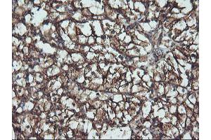 Immunohistochemical staining of paraffin-embedded Human Kidney tissue using anti-ATG3 mouse monoclonal antibody. (ATG3 抗体)