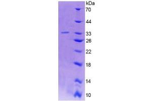 SDS-PAGE analysis of Human GAD2 Protein. (GAD65 蛋白)