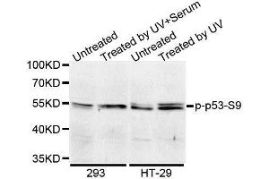Western Blotting (WB) image for anti-Tumor Protein P53 (TP53) (pSer9) antibody (ABIN3023604)
