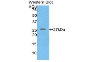Western Blotting (WB) image for anti-Elastin (ELN) (AA 392-645) antibody (ABIN1174510) (Elastin 抗体  (AA 392-645))