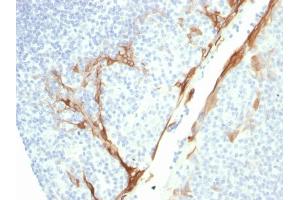 Formalin-fixed, paraffin-embedded human Tonsil stained with CK16 Mouse Recombinant Monoclonal Antibody (rKRT16/1714). (Recombinant KRT16 抗体  (C-Term))