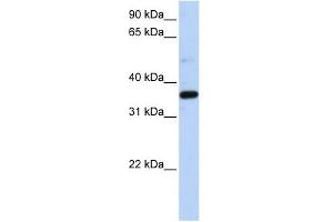 LTB4DH antibody used at 1 ug/ml to detect target protein. (PTGR1 抗体  (N-Term))