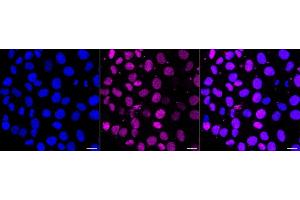 anti-Pim-1 Oncogene (PIM1) antibody