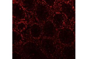 IF analysis of CTBP2 using anti-CTBP2 antibody (ABIN7601326). (CTBP2 抗体  (AA 321-445))