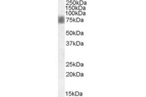 Image no. 1 for anti-NUAK Family, SNF1-Like Kinase, 1 (NUAK1) (Internal Region) antibody (ABIN375083) (NUAK1 抗体  (Internal Region))