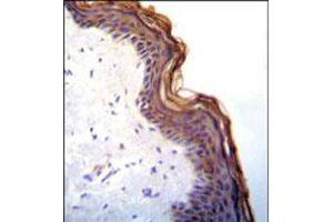 Immunohistochemical staining of formalin fixed and paraffin embedded human skin was performed with KLK7 polyclonal antibody  at 1:10-1:50 dilution followed by indirect peroxidase conjugation with secondary antibody and DAB staining. (Kallikrein 7 抗体  (C-Term))