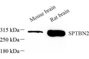 Spectrin, Beta, Non-erythrocytic 2 (SPTBN2) 抗体