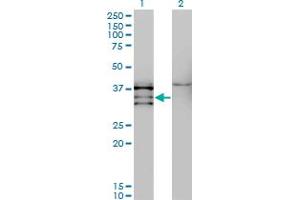 Western Blot analysis of NKX2-5 expression in transfected 293T cell line by NKX2-5 monoclonal antibody (M08), clone 3E3. (NK2 Homeobox 5 抗体  (AA 1-130))