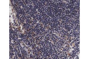 ABIN6267393 at 1/200 staining human lymph node tissue sections by IHC-P. (VAV1 抗体  (pTyr174))