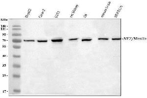 Western blot analysis of NF2/Merlin using anti-NF2/Merlin antibody (ABIN7600115).