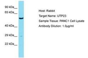 Image no. 1 for anti-UTP23, Small Subunit (SSU) Processome Component, Homolog (UTP23) (AA 151-200) antibody (ABIN6750446) (UTP23 抗体  (AA 151-200))