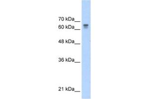Western Blotting (WB) image for anti-Poly (ADP-Ribose) Polymerase Family, Member 6 (PARP6) antibody (ABIN2460859) (PARP6 抗体)