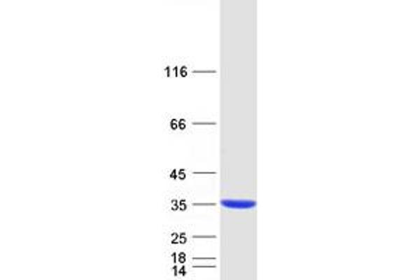 C11orf68 Protein (Transcript Variant 2) (Myc-DYKDDDDK Tag)