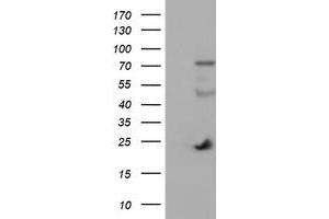 Western Blotting (WB) image for anti-Immunoglobulin J Polypeptide, Linker Protein For Immunoglobulin alpha and mu Polypeptides (IGJ) antibody (ABIN1498839)