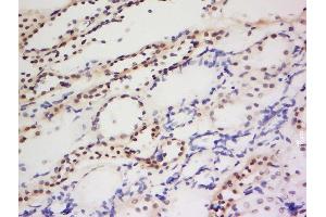 Formalin-fixed and paraffin embedded human kidney labeled with Anti-PIWIL1 Polyclonal Antibody, Unconjugated  at 1:200 followed by conjugation to the secondary antibody and DAB staining. (PIWIL1 抗体  (AA 551-650))