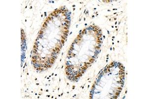 Immunohistochemistry of paraffin embedded human colon using MST1 (ABIN7075561) at dilution of 1: 1000 (400x lens) (STK4 抗体)