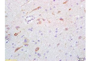 Formalin-fixed and rat brain tissue labeled with Anti-GABA Polyclonal Antibody, Unconjugated  at 1:200 followed by conjugation to the secondary antibody and DAB staining (GABA 抗体)