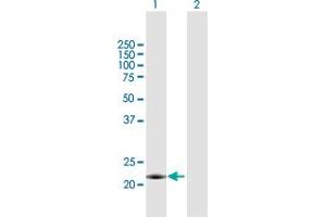 Western Blot analysis of MID1IP1 expression in transfected 293T cell line by MID1IP1 MaxPab polyclonal antibody. (m1ip1 抗体  (AA 1-183))
