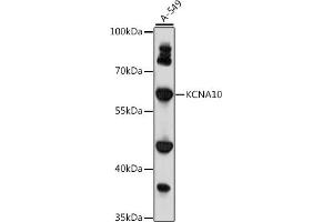 Western blot analysis of extracts of A-549 cells, using KCN antibody (ABIN7269485) at 1:1000 dilution. (KCNA10 抗体  (AA 1-125))