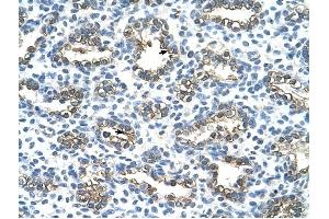 Cytokeratin 13 antibody was used for immunohistochemistry at a concentration of 4-8 ug/ml to stain Alveolar cells (arrows) in Human Lung.