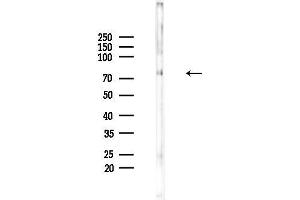 anti-Carnitine Palmitoyltransferase 2 (CPT2) (Internal Region) antibody