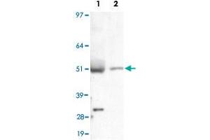 Detection of LIPF in liver lysate using LIPF polyclonal antibody . (LIPF 抗体  (AA 1-100))