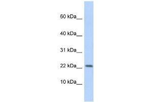 P2RX7 antibody used at 1 ug/ml to detect target protein. (P2RX7 抗体  (Middle Region))