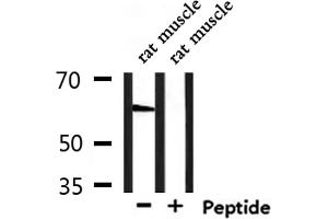 Western blot analysis of extracts from rat muscle, using GPR148 Antibody. (GPR148 抗体)