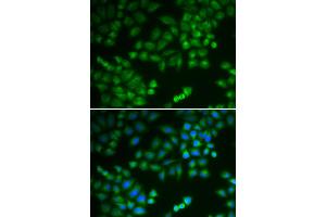Immunofluorescence analysis of MCF-7 cells using RPL5 antibody (ABIN5971027). (RPL5 抗体)