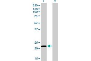 Western Blotting (WB) image for anti-Peroxiredoxin 2 (PRDX2) (AA 1-199) antibody (ABIN598967) (Peroxiredoxin 2 抗体  (AA 1-199))