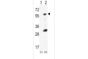 Western blot analysis of GCK using rabbit polyclonal hGCK-S418 using 293 cell lysates (2 ug/lane) either nontransfected (Lane 1) or transiently transfected (Lane 2) with the GCK gene. (GCK 抗体  (C-Term))