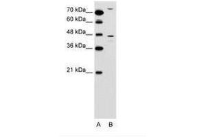 Image no. 1 for anti-Chemokine Binding Protein 2 (CCBP2) (N-Term) antibody (ABIN6736593) (CCBP2 抗体  (N-Term))