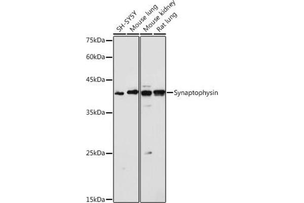 Synaptophysin 抗体  (AA 150-250)