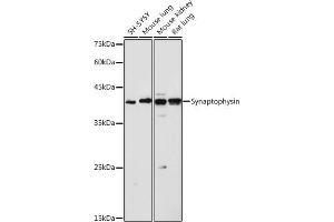 Western blot analysis of extracts of various cell lines, using Synaptophysin antibody (ABIN6135349, ABIN6148783, ABIN6148784 and ABIN6221958) at 1:1000 dilution. (Synaptophysin 抗体  (AA 150-250))
