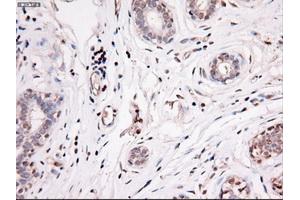 Immunohistochemical staining of paraffin-embedded breast using anti-Nog (ABIN2452676) mouse monoclonal antibody. (NOG 抗体  (AA 28-232))