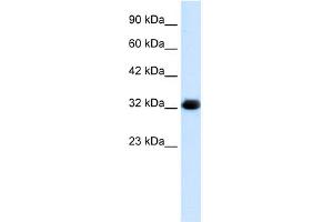 WB Suggested Anti-HS747E2A Antibody Titration:  1. (C22orf31 抗体  (Middle Region))