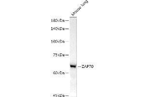 Western blot analysis of extracts of Mouse lung, using Z antibody (ABIN7271430) at 1:1000 dilution. (ZAP70 抗体)
