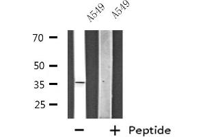 Western blot analysis of extracts from HeLa cells, using ZNF691 antibody. (ZNF691 抗体  (Internal Region))