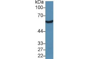 Western Blotting (WB) image for anti-Aldehyde Dehydrogenase 7 Family, Member A1 (ALDH7A1) (AA 1-539) antibody (ABIN1077759)